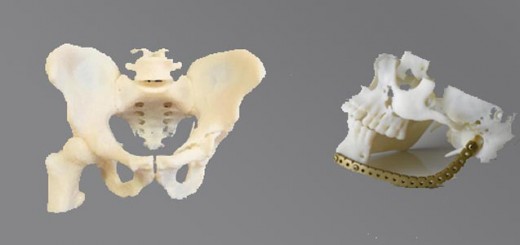 3D printer_bone implant_banner