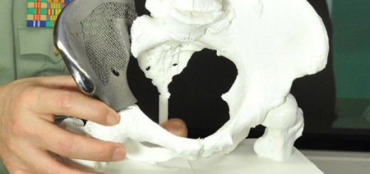 3d-printed-bone-coating-material
