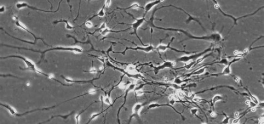 Neuronal progenitor cells