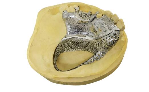 Dental_Renishaw_Egan_2