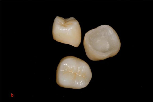Dental_TCT_3