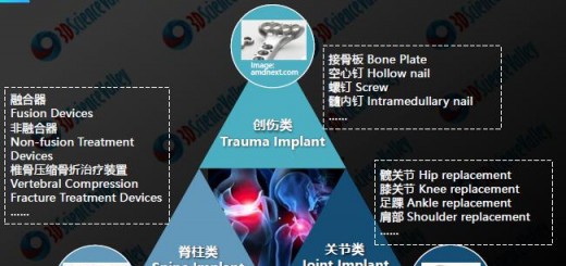 Whitepaper_Orthopedic Implant_3