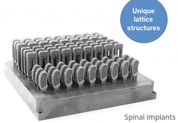 Spinal implants