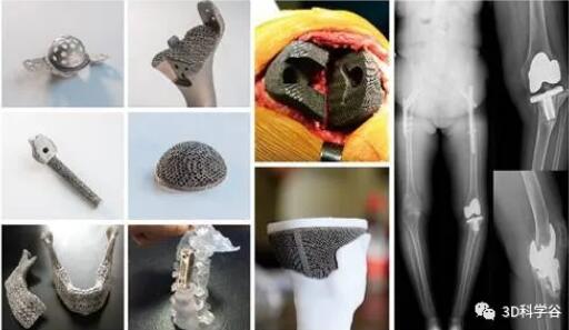 Part_medical_XA Sailong