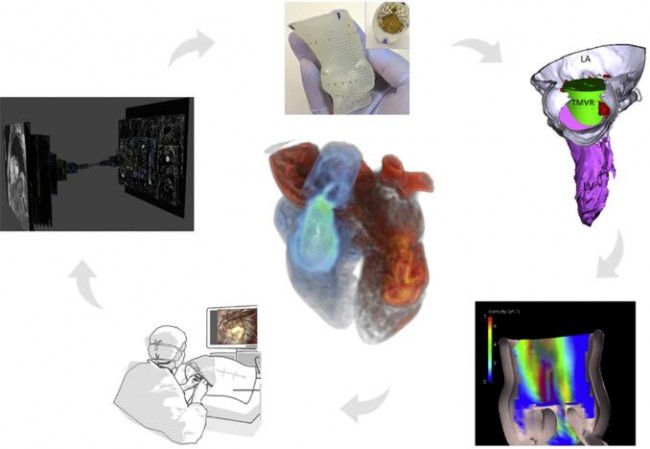 西京医院：3D打印、计算机建模和人工智能在结构性心脏病中的应用展望