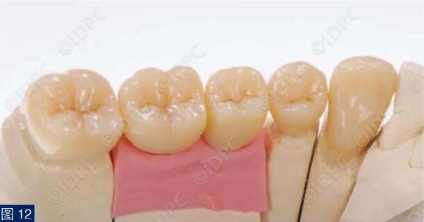 dental_12
